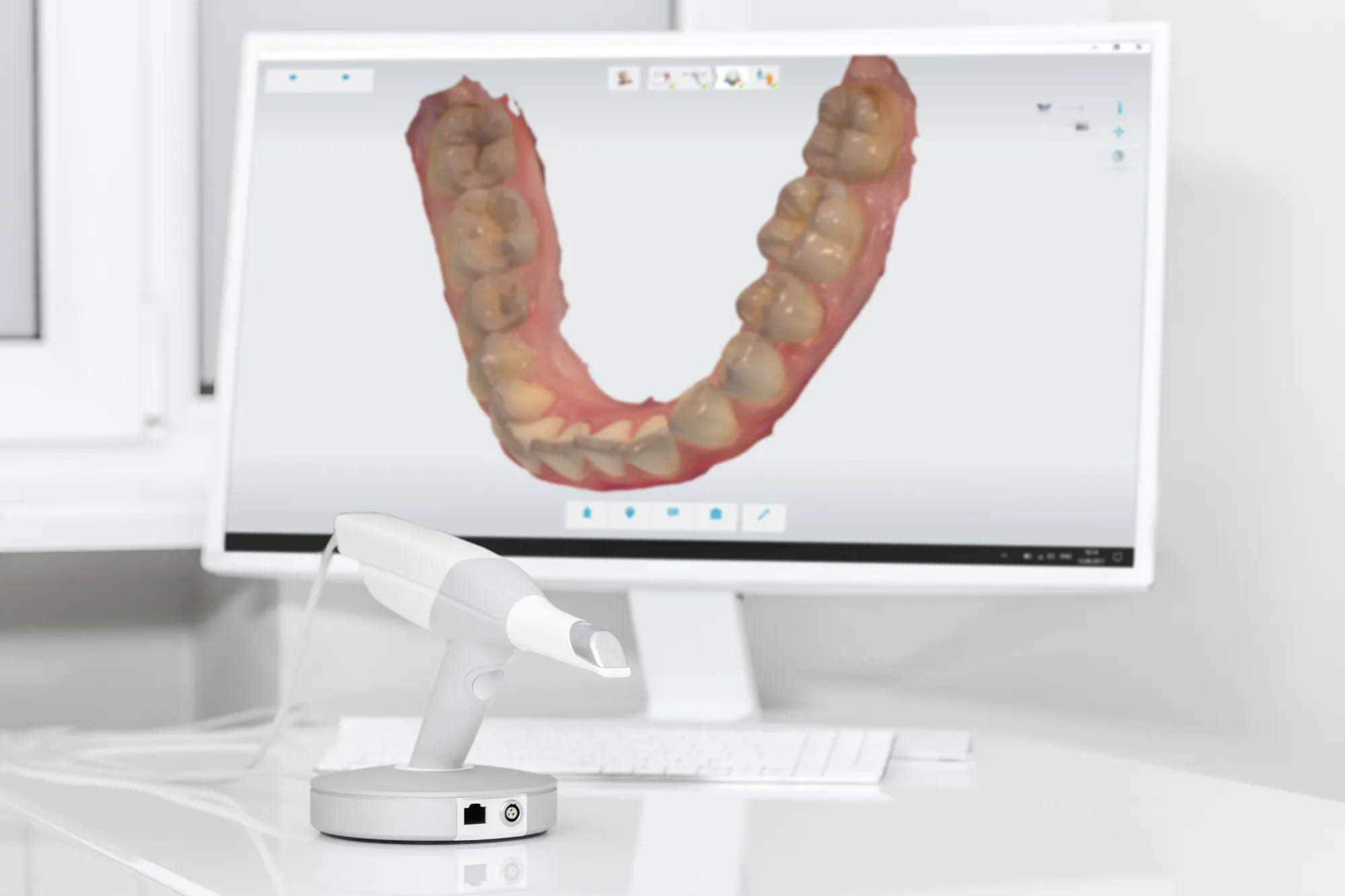 Sala de tratamiento de implantes de Upper Dental en Hollywood, FL