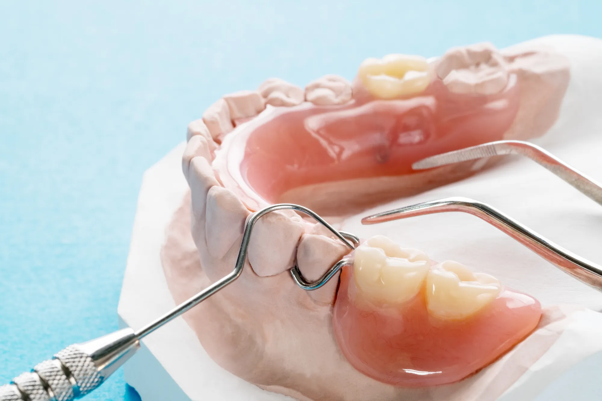 Sala de tratamiento restaurativo de Upper Dental