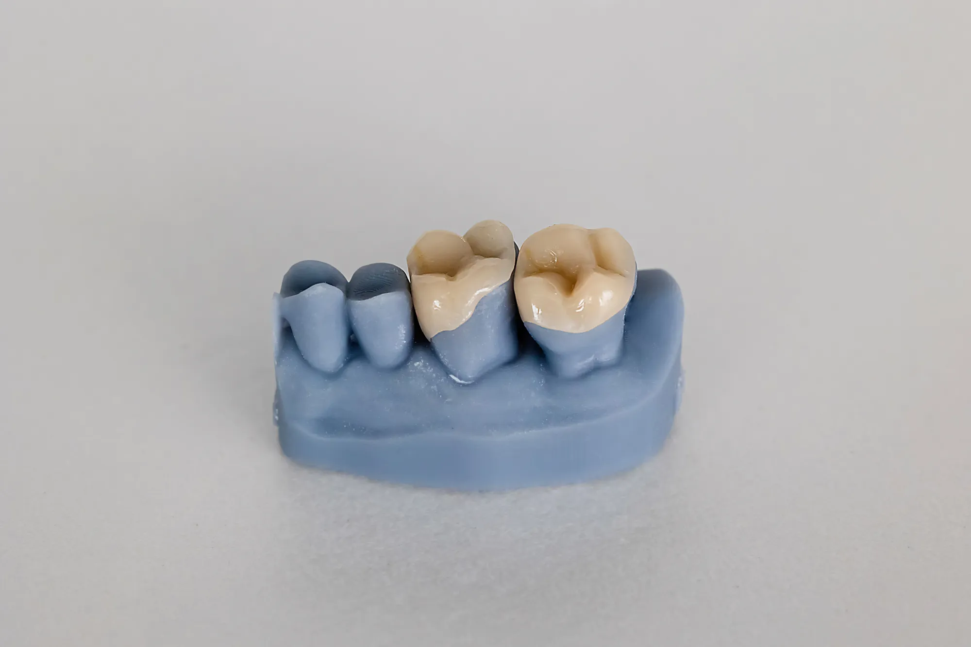 Sala de tratamiento restaurativo de Upper Dental