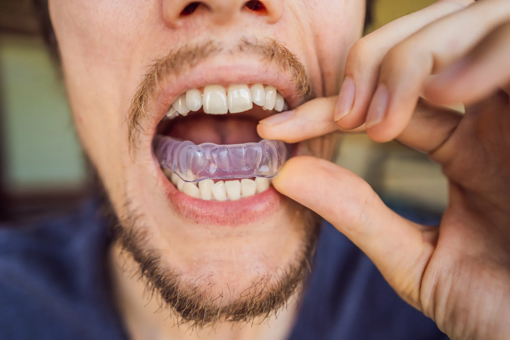 Sala de tratamiento de atención preventiva de Upper Dental